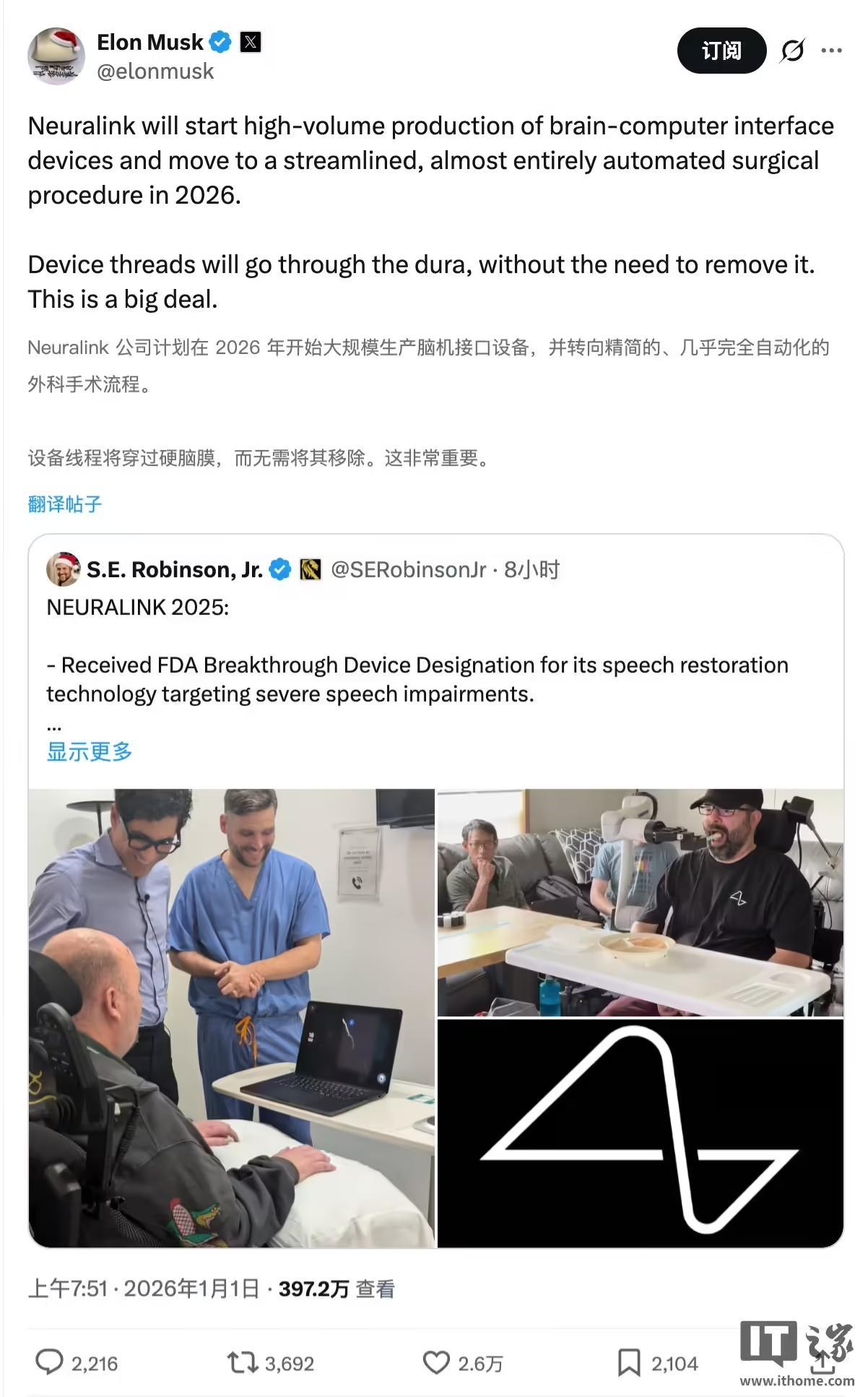 马斯克：2026年将“大规模生产”脑机接口设备